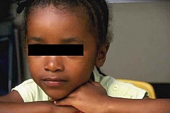 Cameroun : Une fillette de 6 ans violée par son père